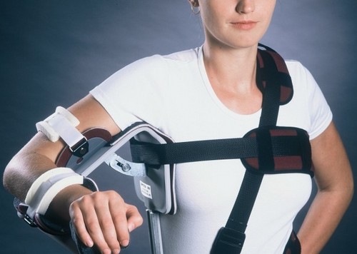 Восстановление после эндопротезирования плеча