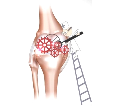 Восстановление работы суставов