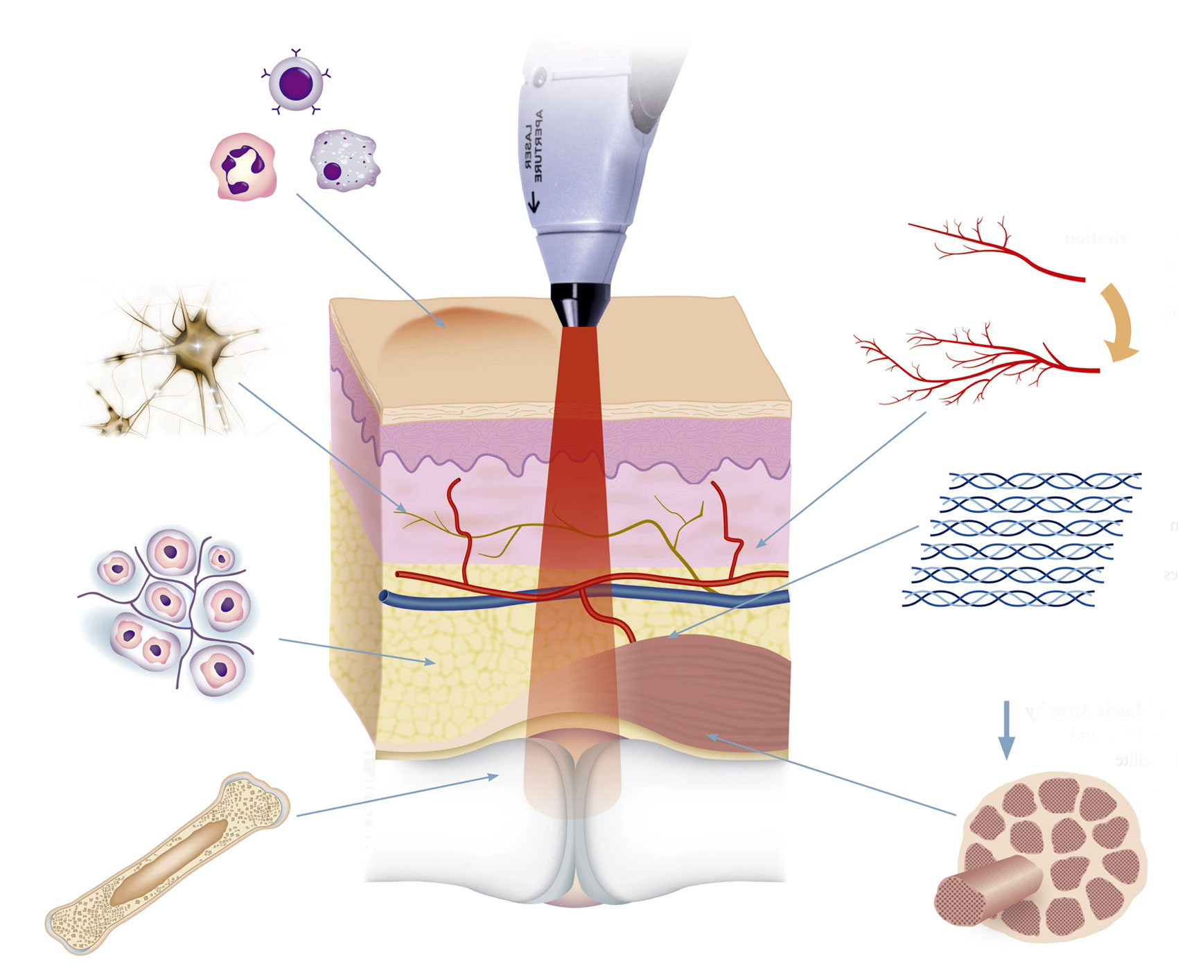 Воздействие лазера на ткани Воздействие лазера на ткани