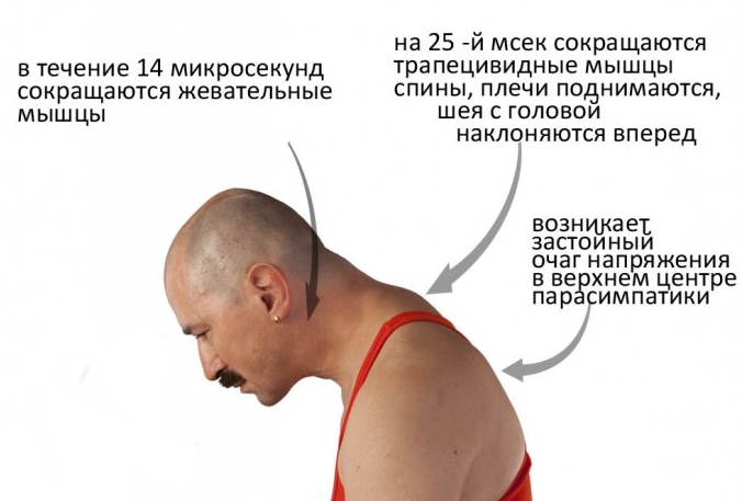 Воздействие стресса на спину Воздействие стресса на спину