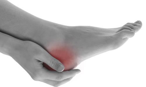 Ощущение боли при пяточной шпоре Ощущение боли при пяточной шпоре