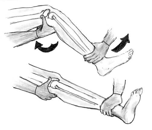 Вправление колена Вправление колена