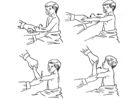 Вправление лучевой кости Вправление лучевой кости