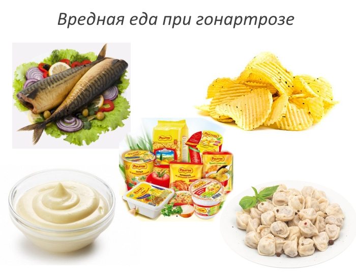 Вредные продукты при гонартрозе Вредные продукты при гонартрозе