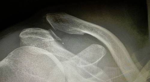 Рентген диагностика Рентген диагностика