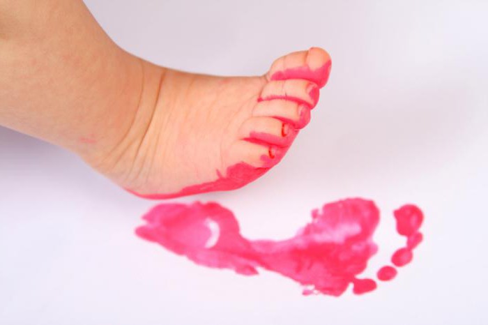 Выявление плоскостопия по следу Выявление плоскостопия по следу