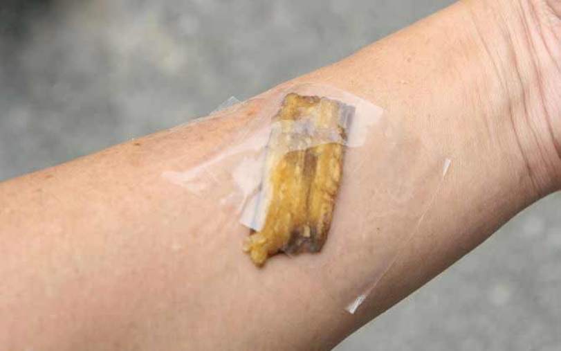 Закрепление шкурки банана